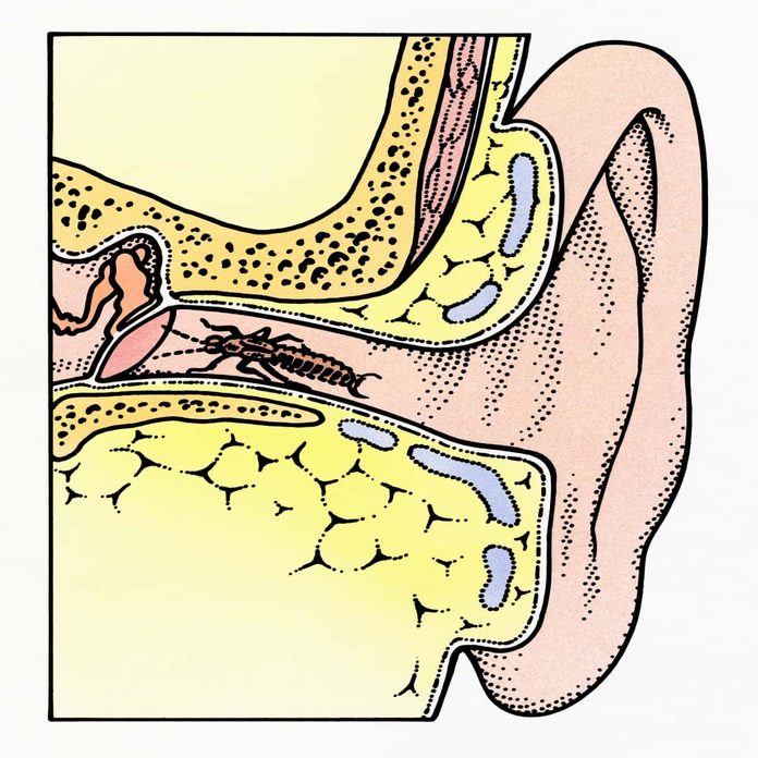 Earwigs in ear